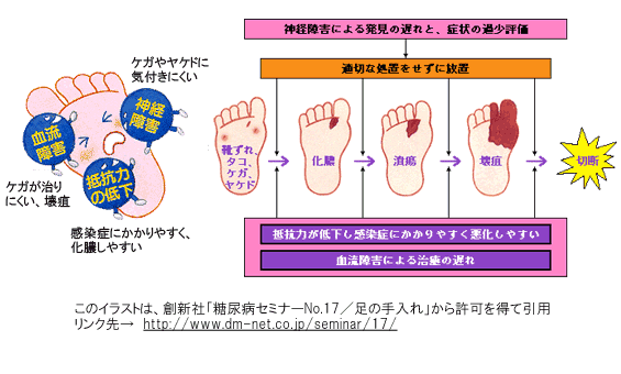 糖尿病セミナー足の手入れ